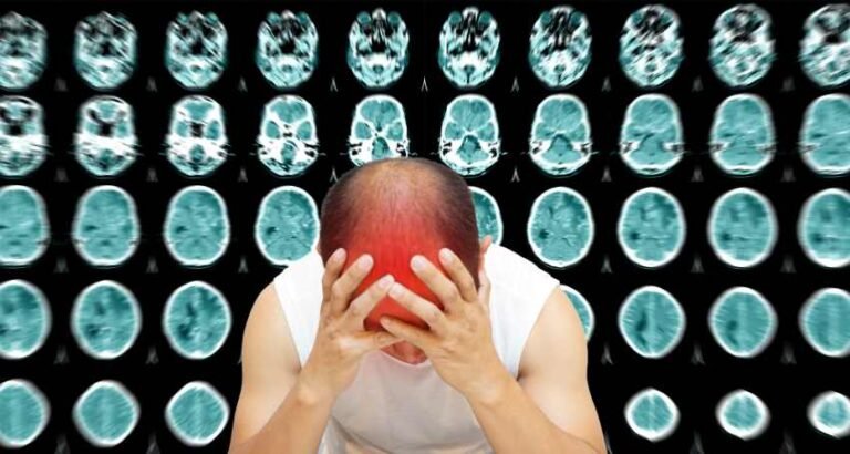 More Critical Evidence of Increased Vaccine-induced Strokes and Deaths